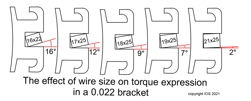 Wire clearance for torque expression in orthodontic bracket size 22 